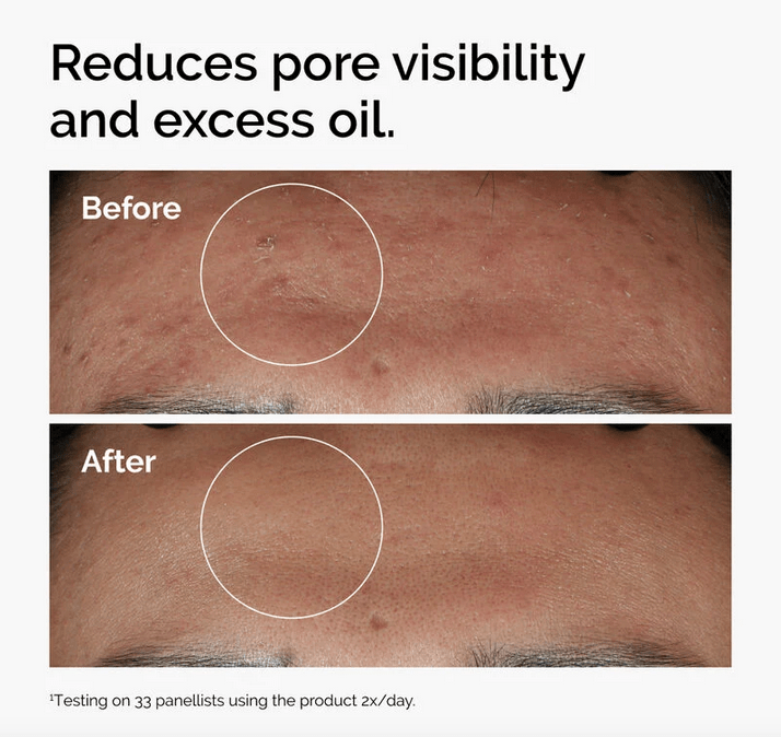 The Ordinary Niacinamide 10% + Zinc 1% - 30ml - PearlMaple